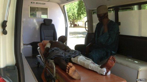 A man who was injured in an attack on a college in Gujba by suspected Islamic militants, lies on a stretcher in an ambulance at the Federal Medical Centre, Nguru, Yobe state -30 September 2013