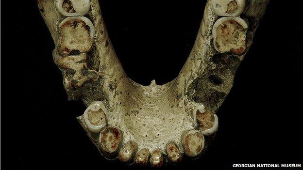 Heavy tooth wear on hominid fossil