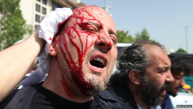 Ahmet Sik hit on the head by a teargas