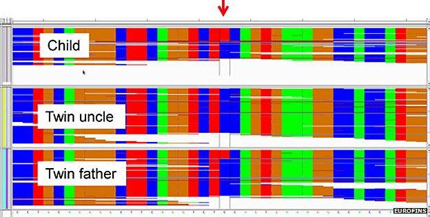 Results from Eurofins test showing one of the mutations