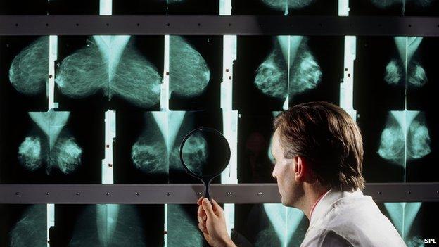 Doctor looking at mammograms
