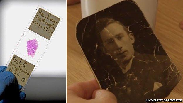 Microscope slide containing prostate tissue sample of Rouse's victim; family photo of William Thomas Briggs