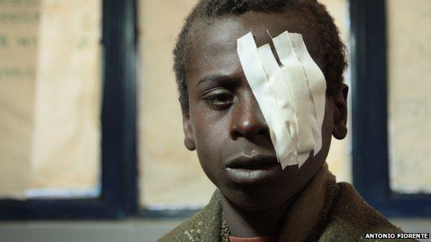 boy with bandage over one eye