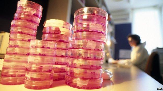 Petri dishes filled with stem cells