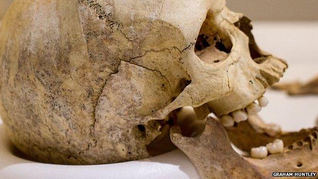 One of the skulls in Eastbourne Museum