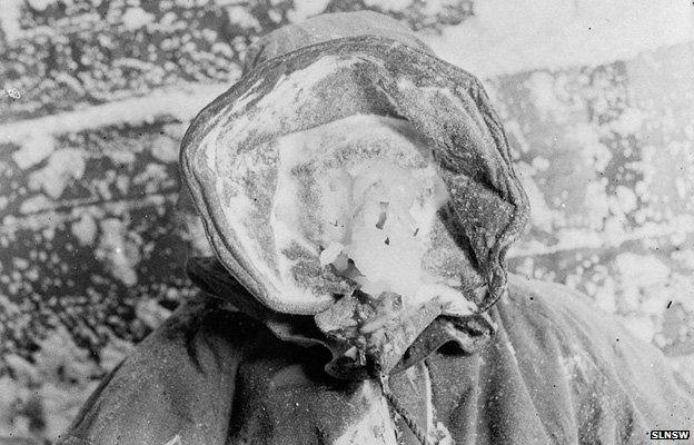 An expedition member with an "ice mask"