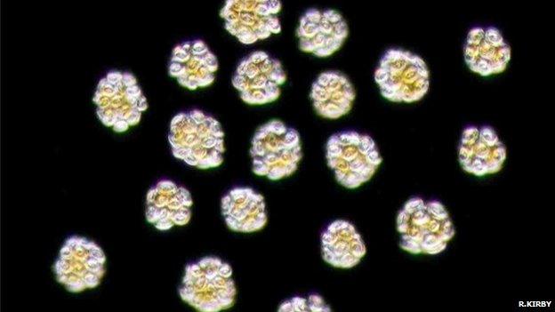 Phaeocystis globosa (Image courtesy of Dr Richard Kirby)