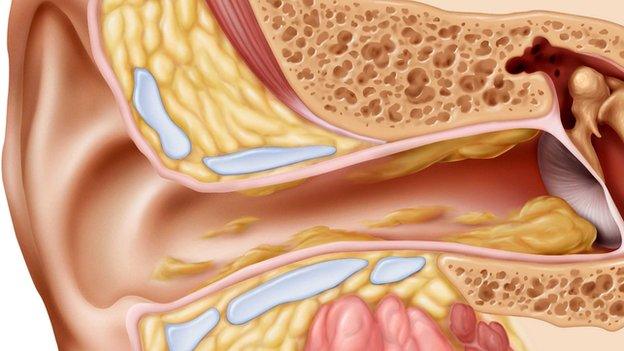 The cul-de-sac of the ear canal