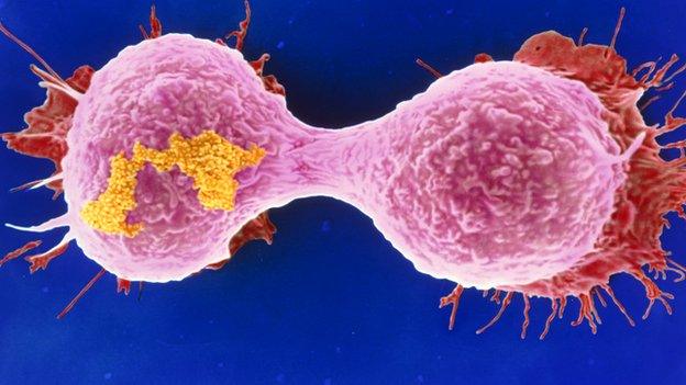 Breast cancer cell