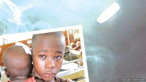 A photo of Satrin Osinya holding onto his brother Moses Gift in Mombasa on 25 March 2014 - and an X-ray of the bullet