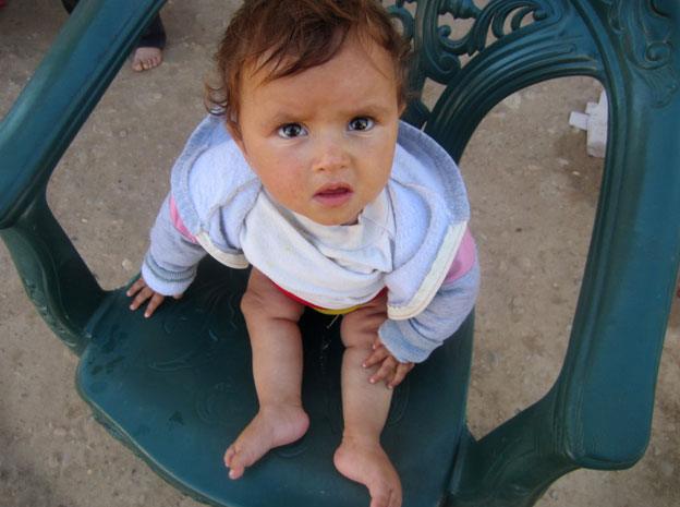 Syrian child with polio