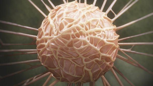Breast cancer cell