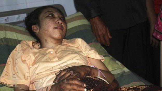 Indonesian domestic helper Erwiana Sulistyaningsih lies in a bed whilst being treated at a hospital in Sragen, Indonesia"s Central Java province, 17 January 2014