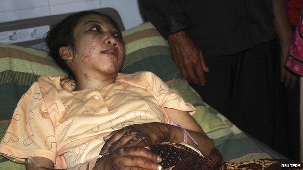 Indonesian domestic helper Erwiana Sulistyaningsih lies in a bed whilst being treated at a hospital in Sragen, Indonesia's Central Java province, 17 January 2014