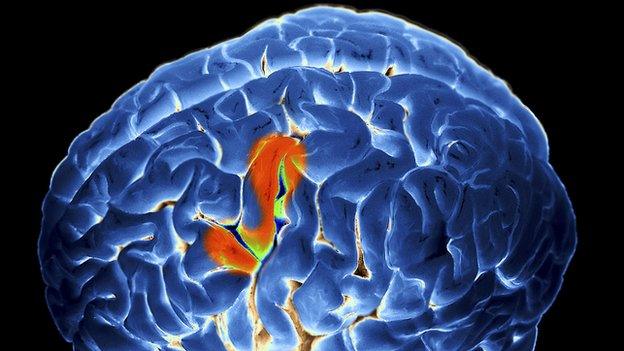 Brain activity during speech