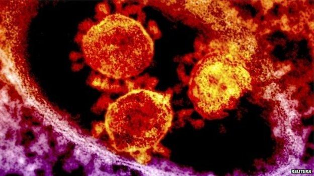 Particles of the Middle East respiratory syndrome (MERS) coronavirus that emerged in 2012 are seen in an undated colorized transmission electron micrograph from the National Institute for Allergy and Infectious Diseases (NIAID)