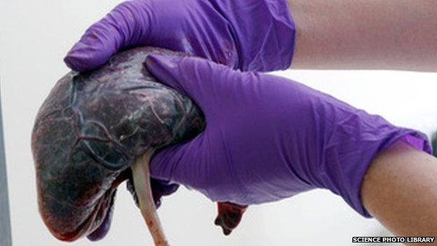 A placenta