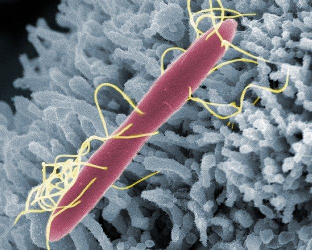 A C. diff cell colonising the microvilli on a mouse's intestinal cell