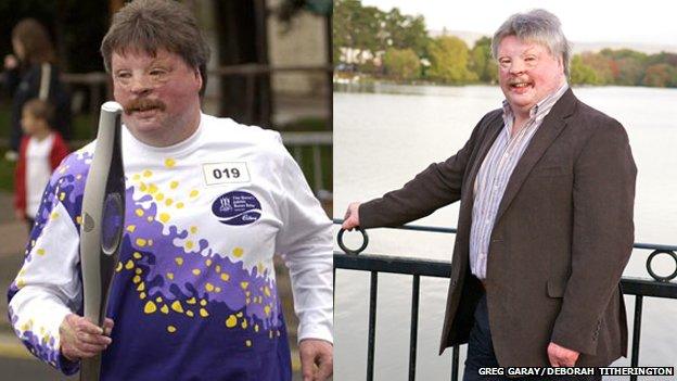 Simon Weston, pictured in 2002 and nowadays