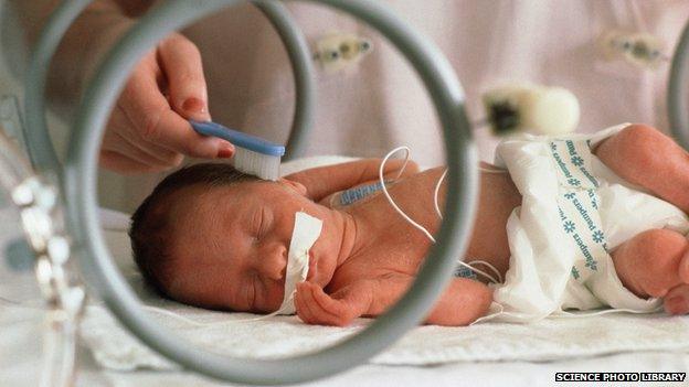 A premature baby in a neonatal unit