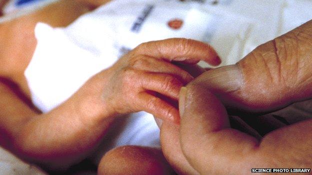 Holding a premature baby's hand