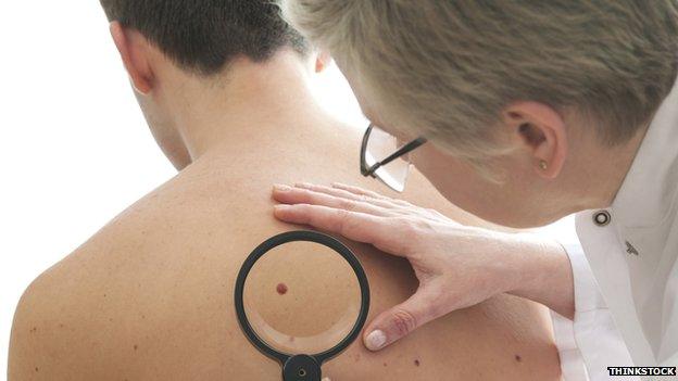 Doctor examining mole on patient