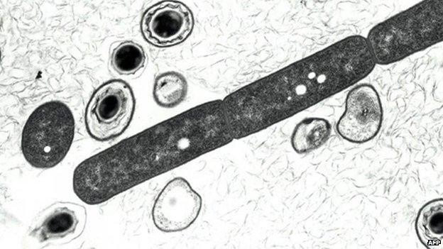 Anthrax bacterium, shown in a 2001 US defence department photo