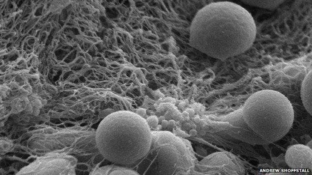 Scanning electron micrograph picture of spherical super clotting particles