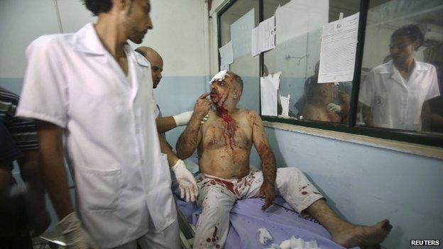 A Palestinian man, who medics said was wounded in an Israeli air strike in Khan Younis. Photo: 8 July 2014