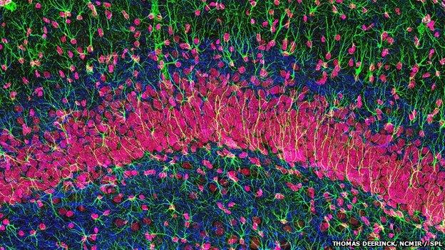 hippocampus brain tissue