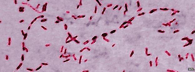 Bordetella pertussis