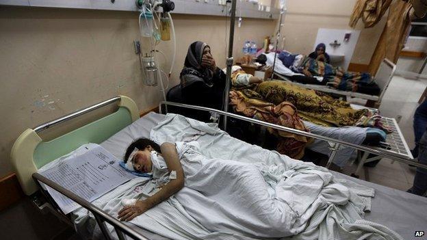 Palestinian Beisan Dhahir, 7, sleeps at Shifa hospital in Gaza City where he is recovering after being injured in an airstrike on his home - 20 July 2014