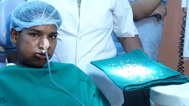 Indian teenager Ashik Gavai with some of his 232 teeth