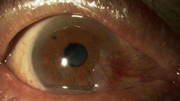 A close up of an eye