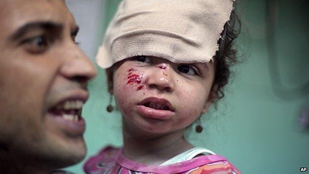 A Palestinian man carries a wounded girl at the Kamal Adwan hospital in Beit Lahiya after receiving treatment for her wounds caused by an Israeli strike at a UN school in Jebalia refugee camp, northern Gaza Strip, Wednesday, July 30