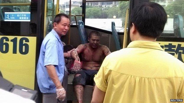 Rescue workers help an injured man into a hospital near the site of the factory explosion in Kunshan - 2 August 2014