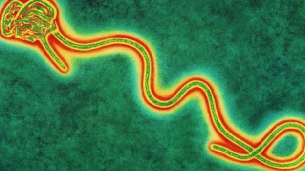 Coloured transmission electron micro graph of a single Ebola virus, the cause of Ebola fever