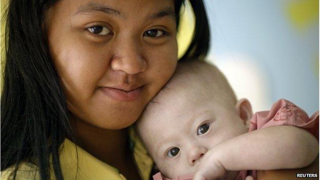 Gammy, a baby born with Down's Syndrome, is held by his surrogate mother Pattaramon Janbua at a hospital in Chonburi province 3 August 2014