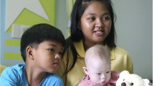 Pattaramon Chanbua, 21, top, poses with her children Game, 7, left, and baby boy Gammy at a hospital in Chonburi province, southeastern Thailand Sunday, 3 Aug 2014.