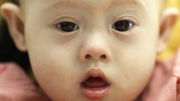 Gammy, a baby born with Down's Syndrome, is held by his surrogate mother Pattaramon Janbua (not seen) at a hospital in Chonburi province 3 August 2014.