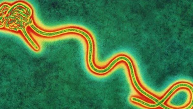 Coloured transmission electron micro graph of a single Ebola virus, the cause of Ebola fever