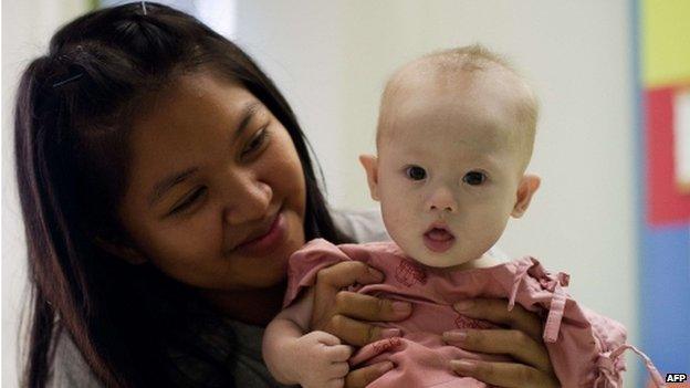 Thai surrogate mother Pattaramon Chanbua (left) holds with her baby Gammy, born with Down's Syndrome, at the Samitivej hospital, Sriracha district in Chonburi province on 4 August 2014