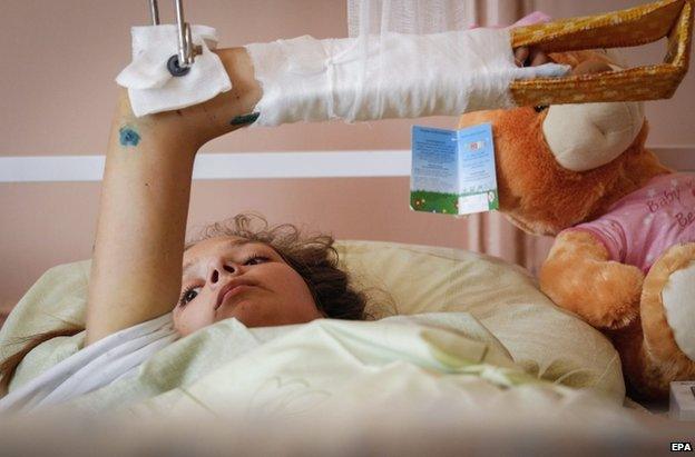 Yana Fenenko, 15, lies on a bed in a children's hospital after suffering severe shrapnel wounds in Donetsk, Ukraine, 20 August