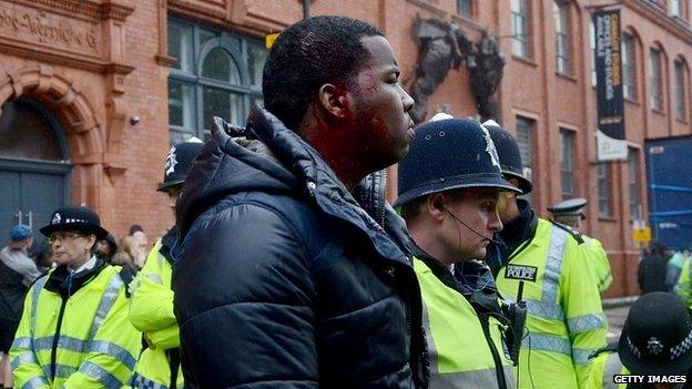 Police with an injured man with blood on his face