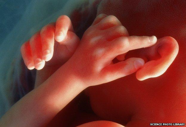 Ear and hands of a male foetus aged 20 weeks