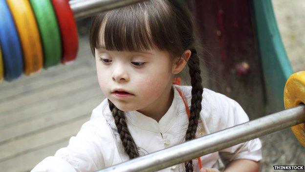 A little girl with Down's syndrome playing with an abacus