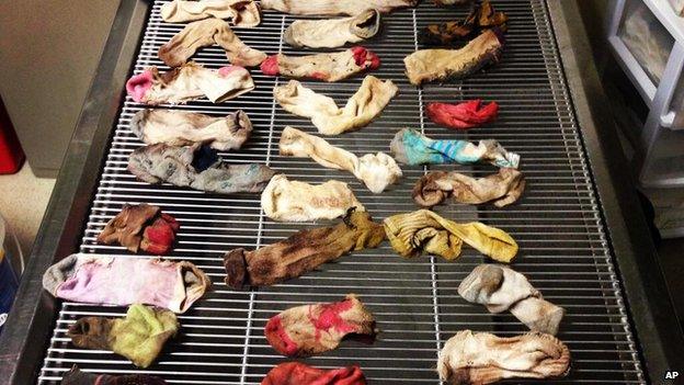 A photo shows a handful of the socks that were removed from the dog's stomach