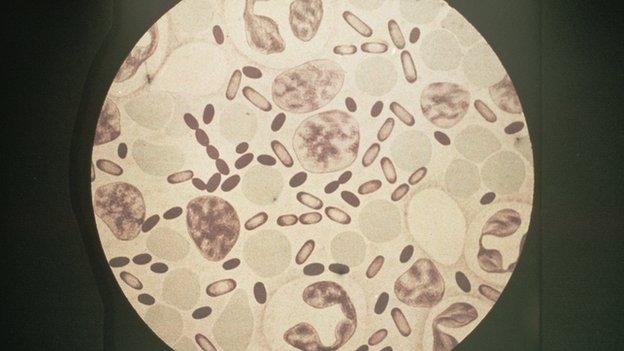 Bubonic plague bacteria