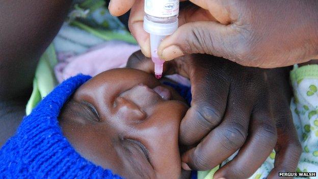 Baby gets oral polio vaccine