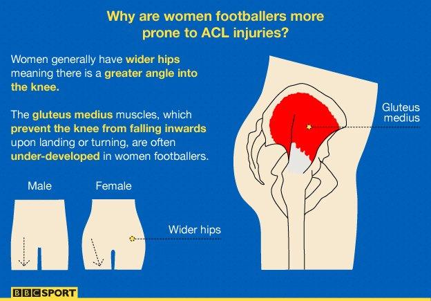 Women's knee injuries